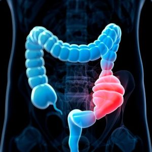 foods to avoid for constipation article
